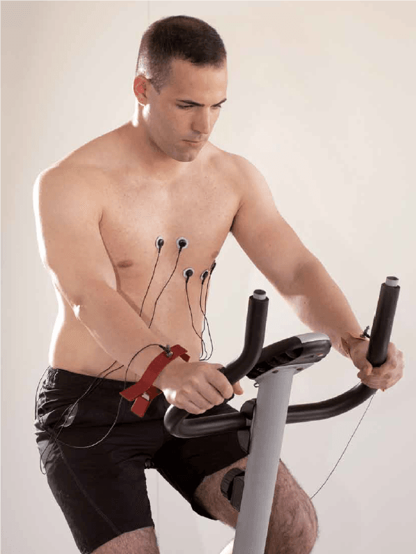 ECG