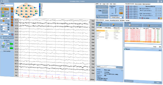 Software de adquisición TruScan EEG
