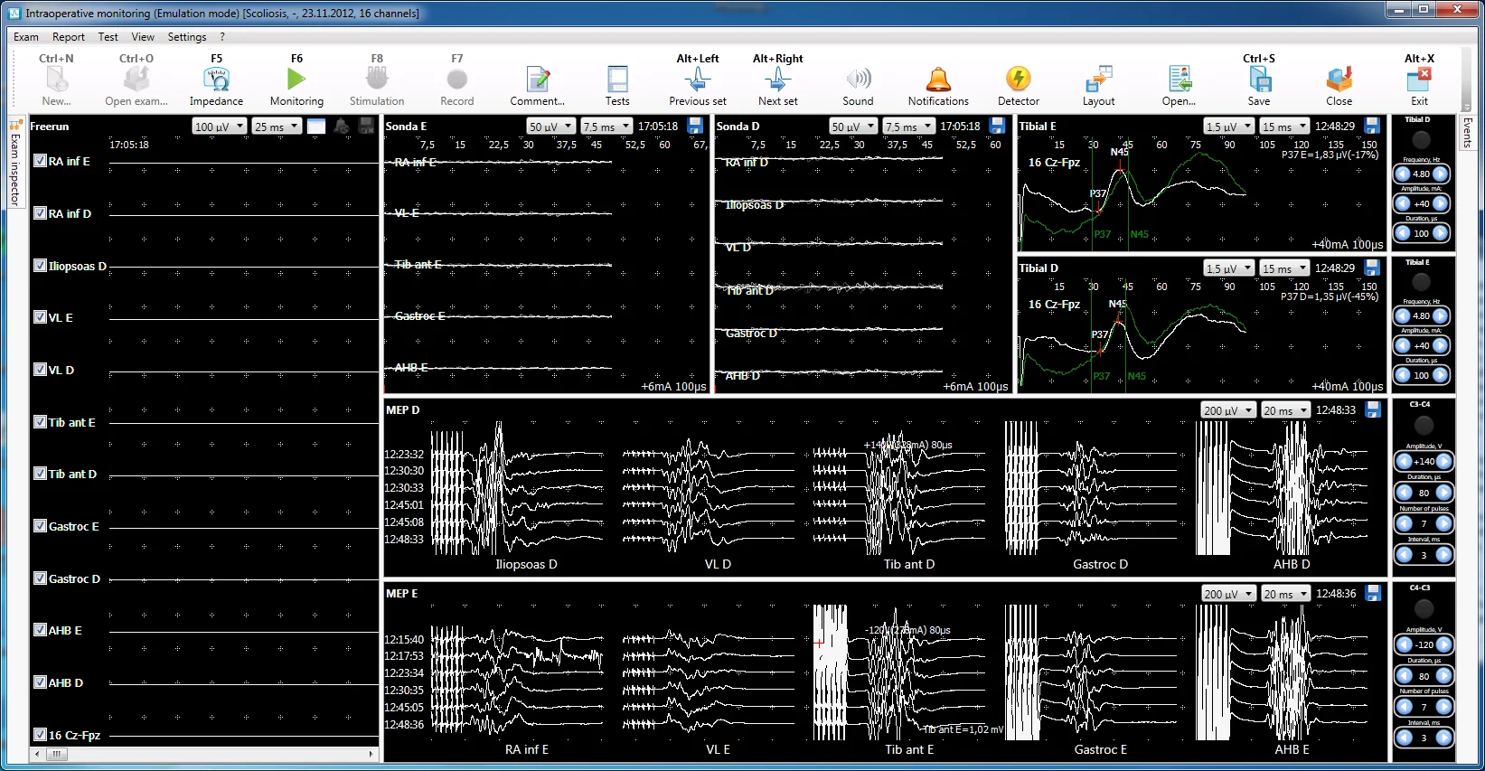 Software Neuro-IOM.NET